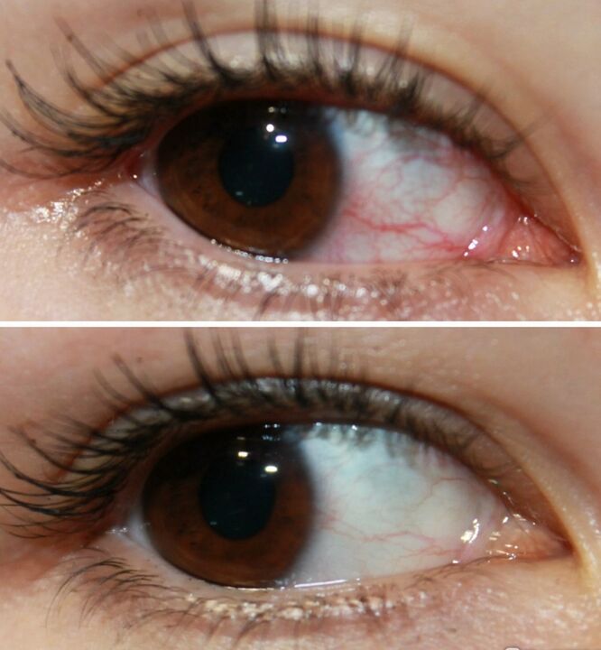 Ocuvit çok hızlı davranıyor